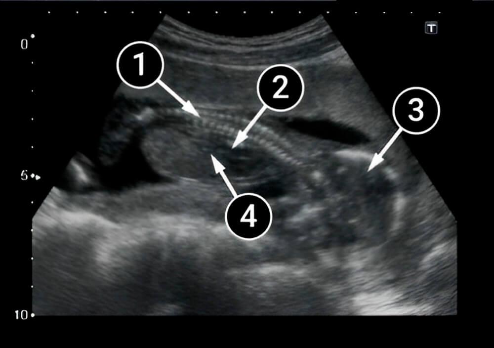 Наружные половые органы уже видны
